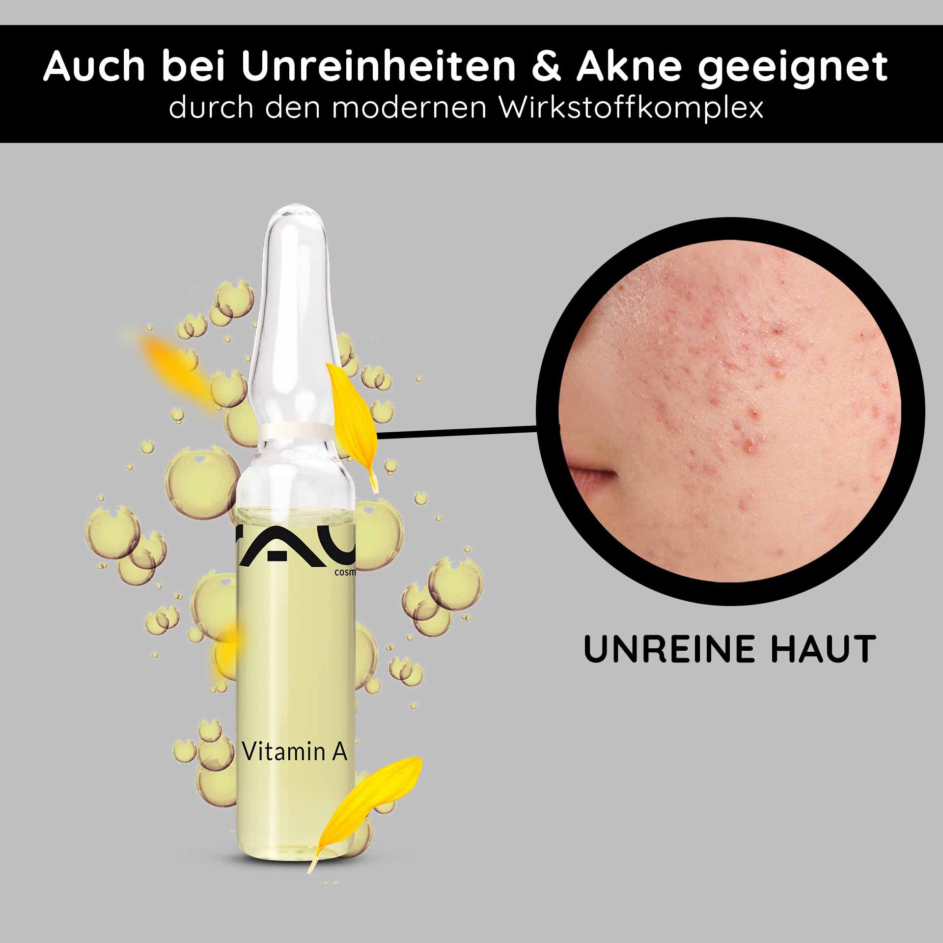 Vitamin A Ampoules 14x2 ml Retinol Serum Vitamin A Ampulle von RAU Cosmetics, hervorgehoben für Akne und Unreinheiten, mit einer Nahaufnahme unreiner Haut, umgeben von Blasen und Blütenblättern, die den modernen Wirkstoffkomplex hervorheben.