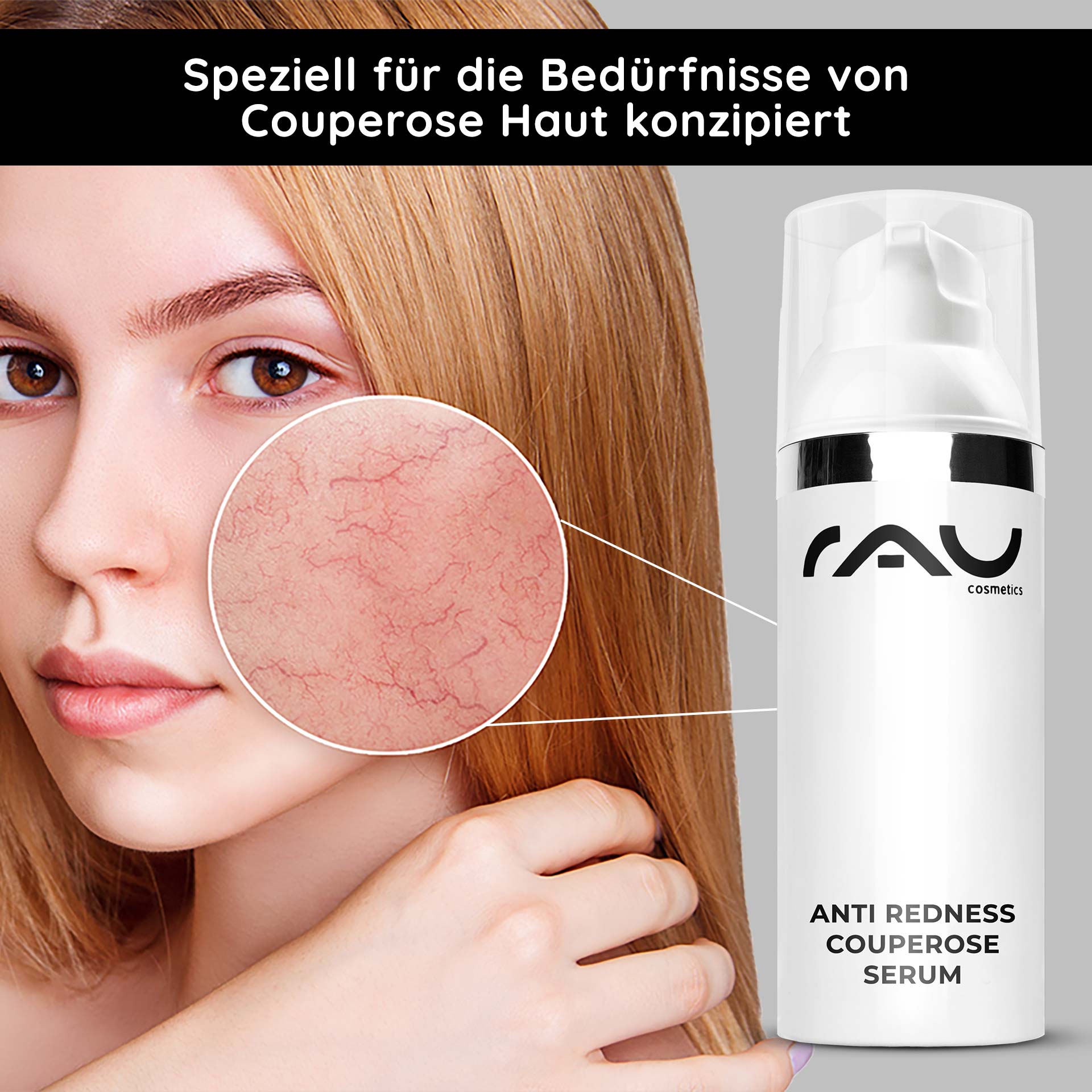 Anti Redness Couperose Serum 50 ml for Rosacea Frau mit blonder Haar und betontem roten Hautbereich, RAU Cosmetics Anti Redness Couperose Serum im Vordergrund, speziell für Couperose-Haut entwickelt.