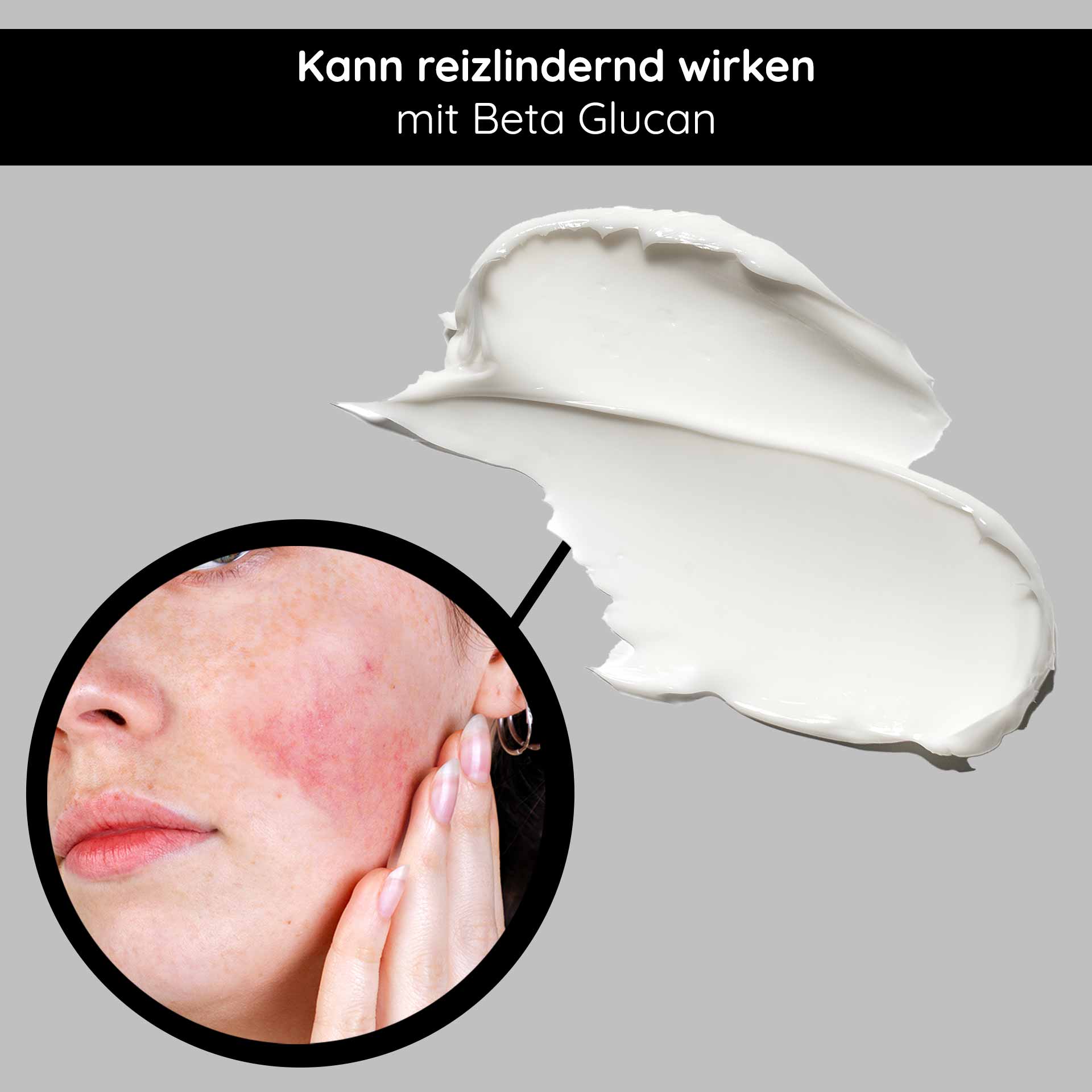 Beta Glucan Recovery Mask 200 ml Mask for Irritated Skin Gesichtsmaske mit Beta Glucan, Anwendung zur Linderung von Hautirritationen, Nahaufnahme einer Person mit gereizter Haut und Creme.