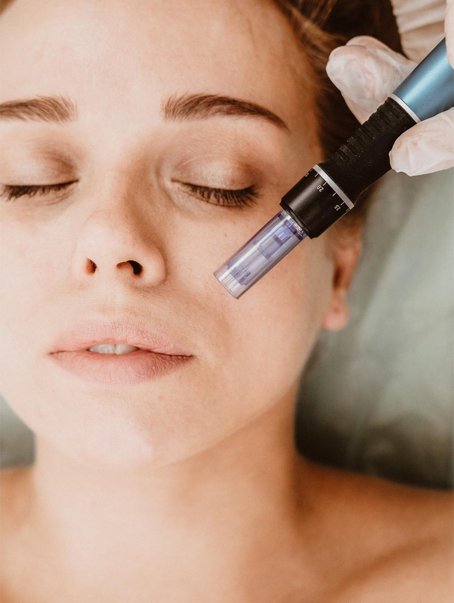 microneedling-darauf-solltest-du-achten