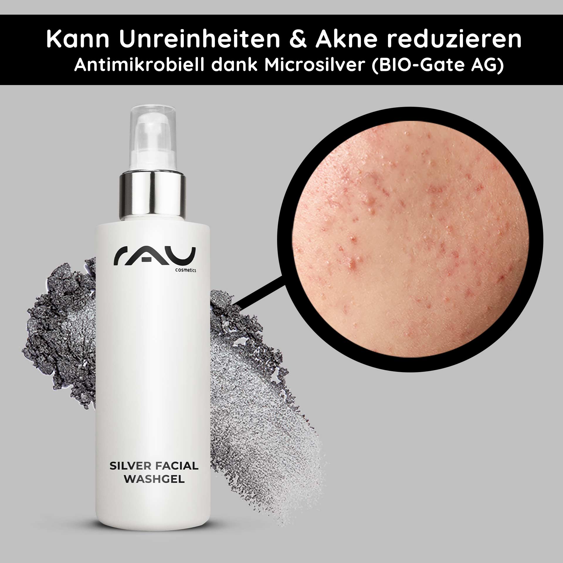 Silver Facial Washgel 200 ml Microsilver Cleanser Flasche RAU Silver Facial Washgel mit antimikrobiellem Mikrosilber, Nahaufnahme von Haut mit Akne und Unreinheiten, mit Hervorhebung der Vorteile fΓΌr empfindliche und zu Akne neigende Haut.