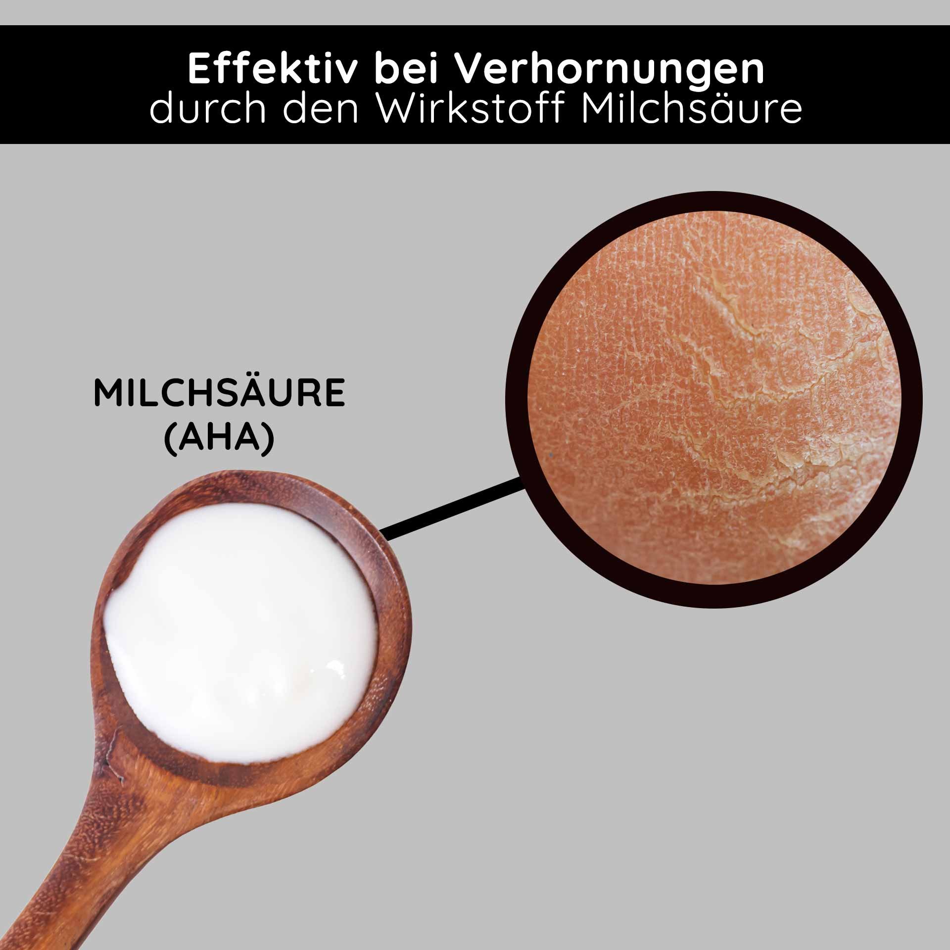 Milchsäure (AHA) in einem Holzlöffel, wirksam gegen Verhornungen, mit Hauttextur im Detail.