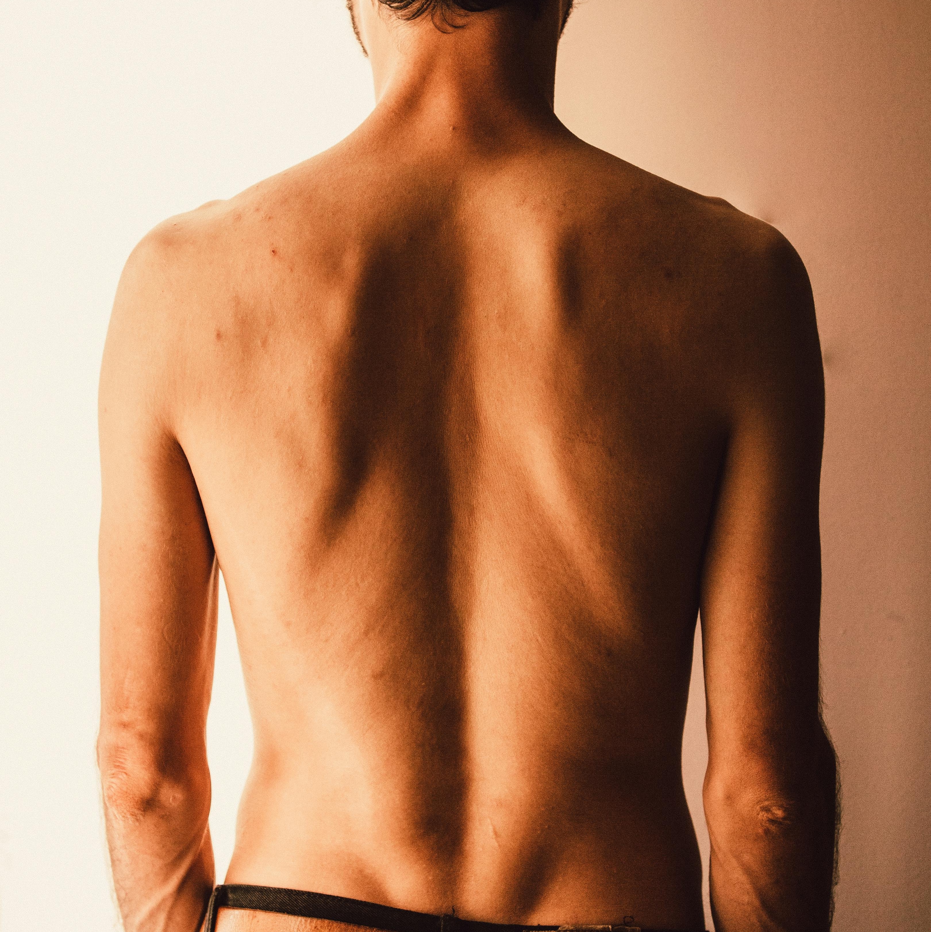 This helps against pimples on the back Frau mit Rückenansicht, die sich mit beiden Händen über die Schultern streckt, während sie in einem weißen Badetuch vor einem Spiegel steht.