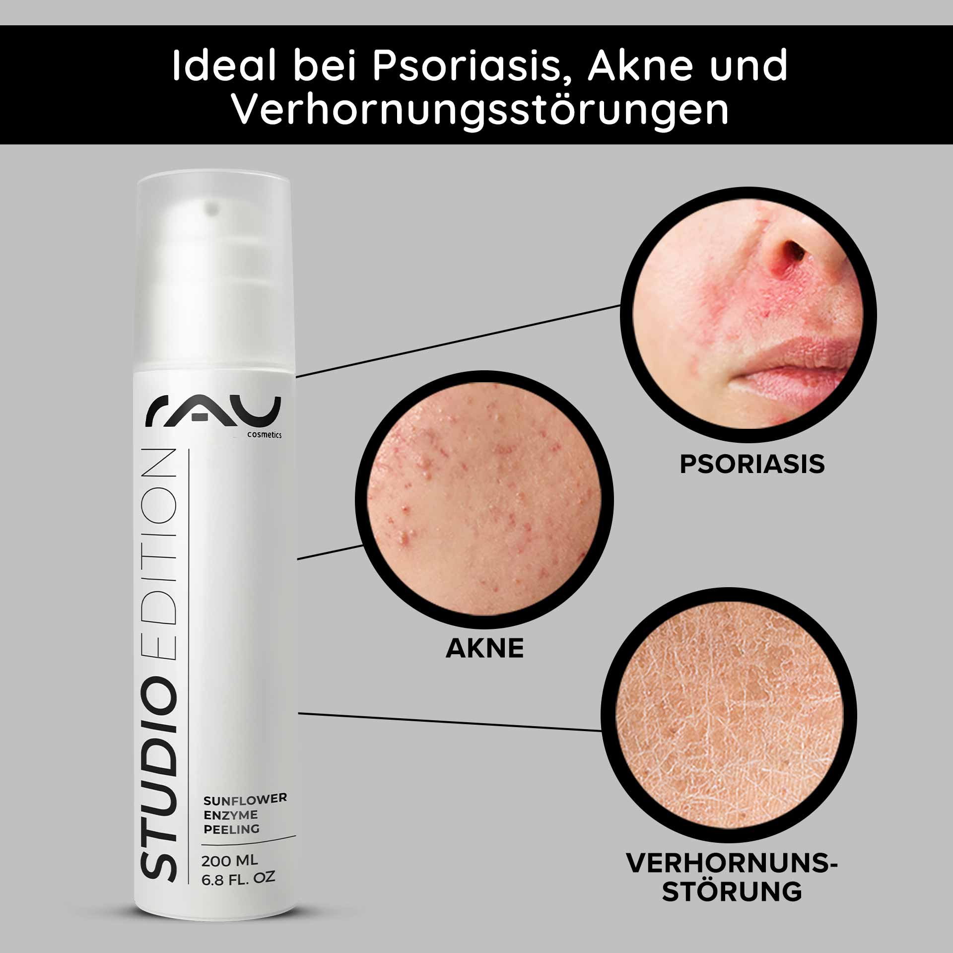 Sunflower Enzyme Peeling 200 ml Chemical Enzyme Peeling Verpackung des RAU Sunflower Enzyme Peeling mit hervorgehobenen Vorteilen bei Schuppenflechte, Akne und Keratose; Nahaufnahmen von Hautzuständen veranschaulichen die Wirksamkeit.