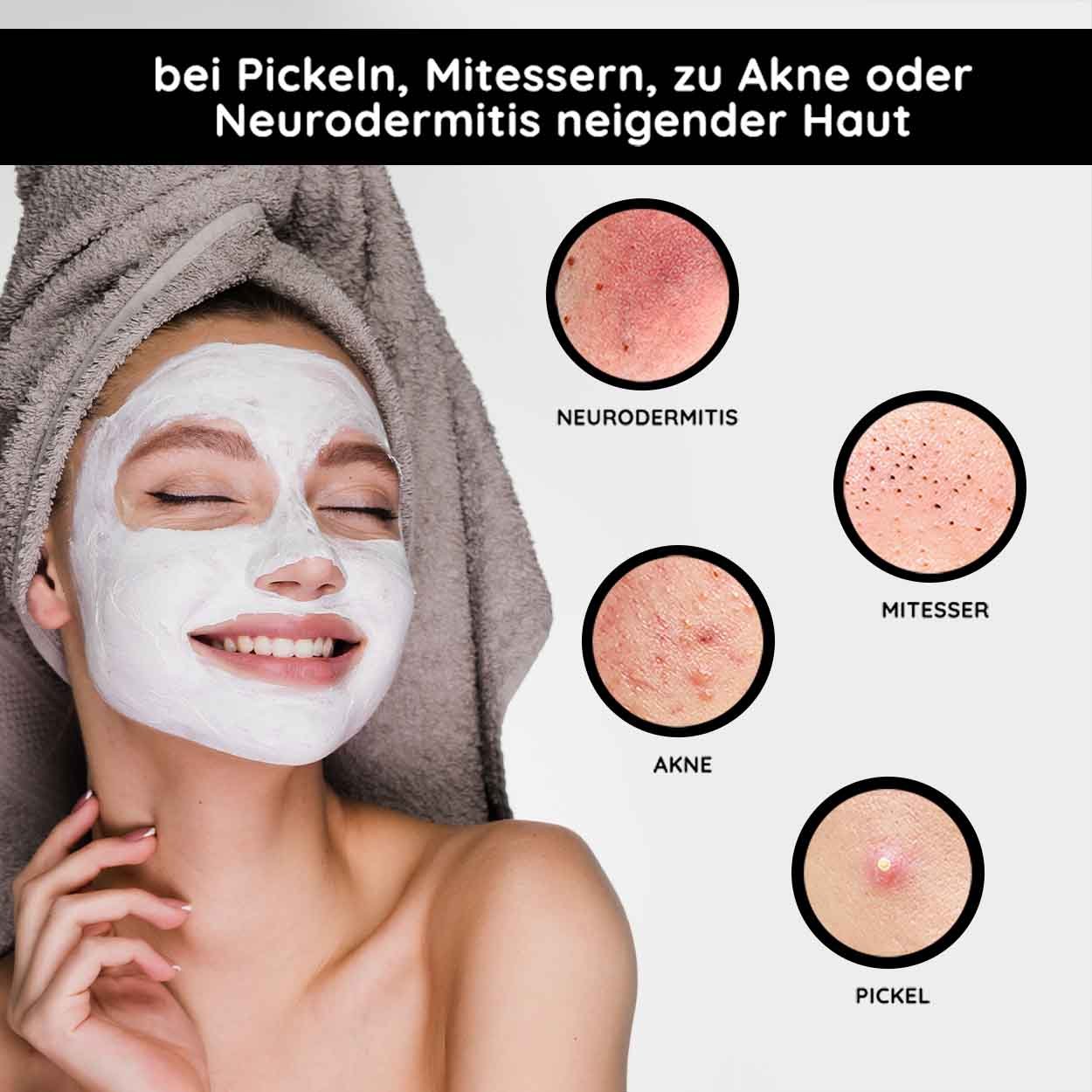 Lächelnde Frau mit Gesichtsmaske, umgeben von Bildern von Hautunreinheiten wie Pickeln, Mitessern, Akne und Neurodermitis, veranschaulicht die Anwendung der RAU Cosmetics Mineral Mask für problematische Haut.