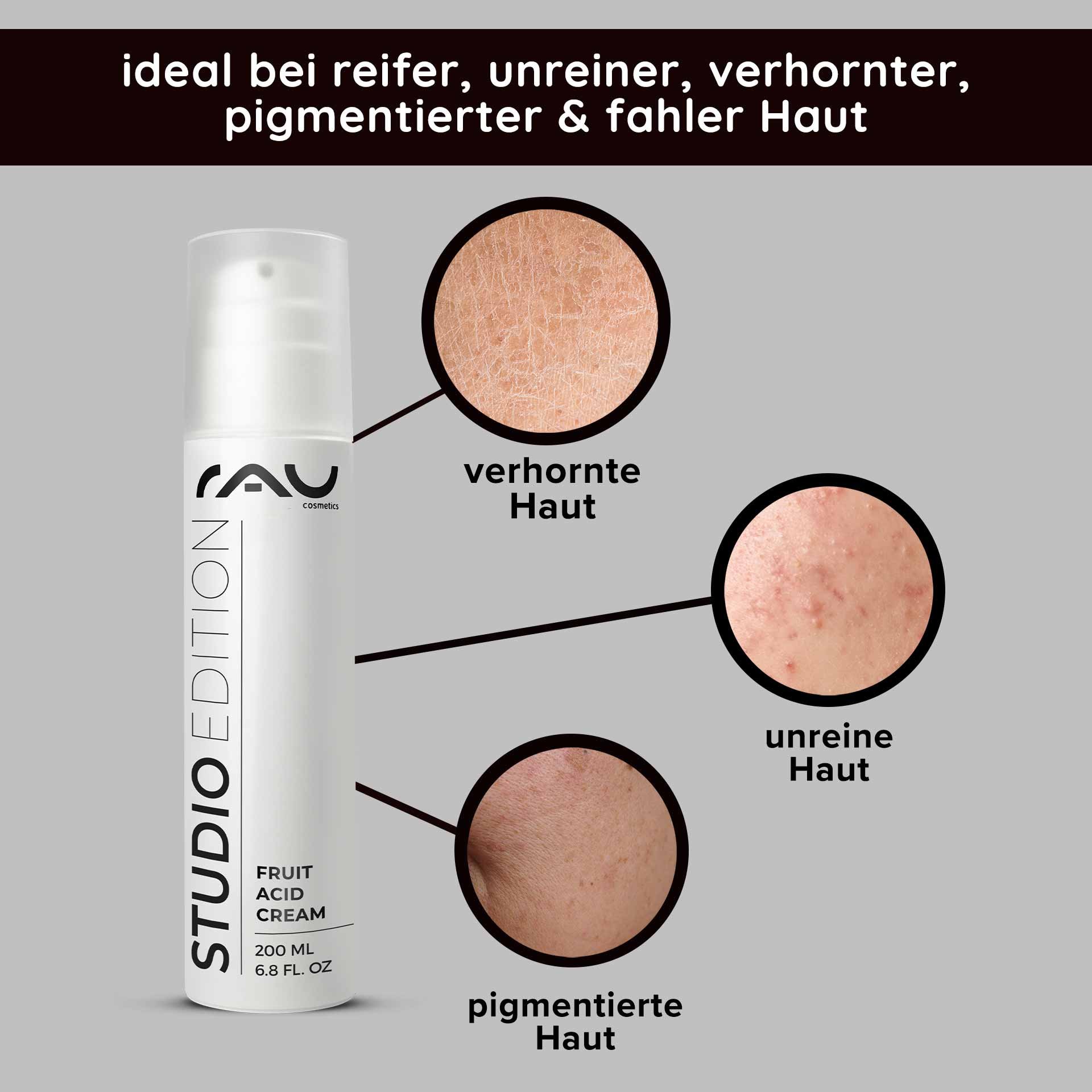 RAU Cosmetics Fruit Acid Cream Verpackung mit hervorgehobenen Hautproblemen: verhornte, unreine und pigmentierte Haut, ideal für reife und fahle Haut.