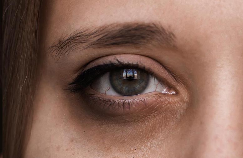 rau-cosmetics-dunkle-augenringe-02 b0/57/93/1697977