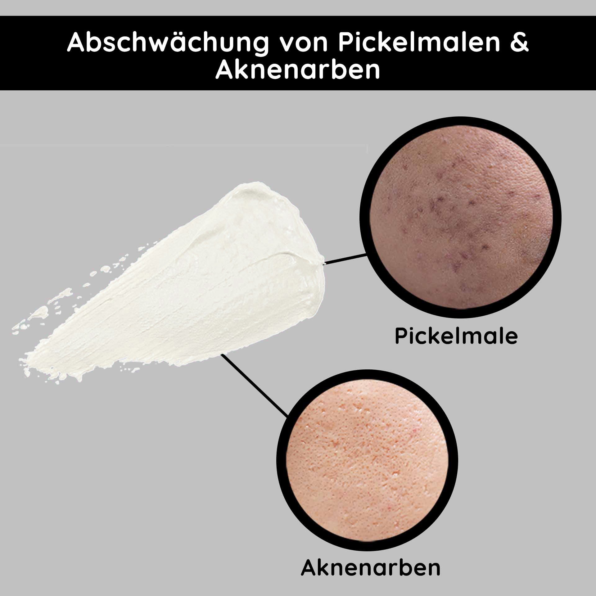 Reichhaltige Nachtcreme von RAU Cosmetics zur Abschwächung von Pickelmalen und Aknenarben, mit Ginkgo-Extrakt für trockene Haut.