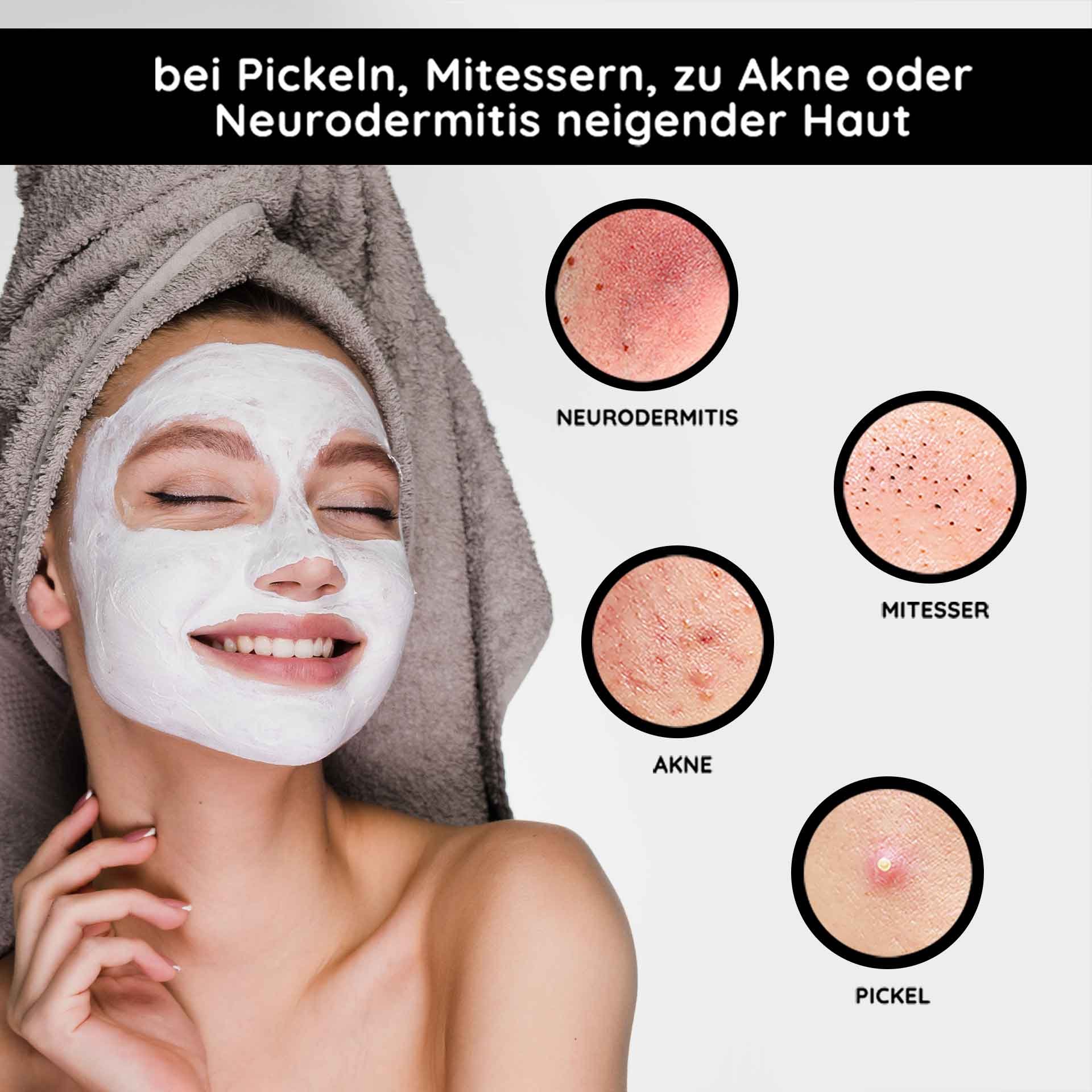 Smiling woman with a skincare face mask, surrounded by images of skin problems such as acne, blackheads, and neurodermatitis, presenting the benefits of the RAU Cosmetics Mineral Mask for problematic skin.