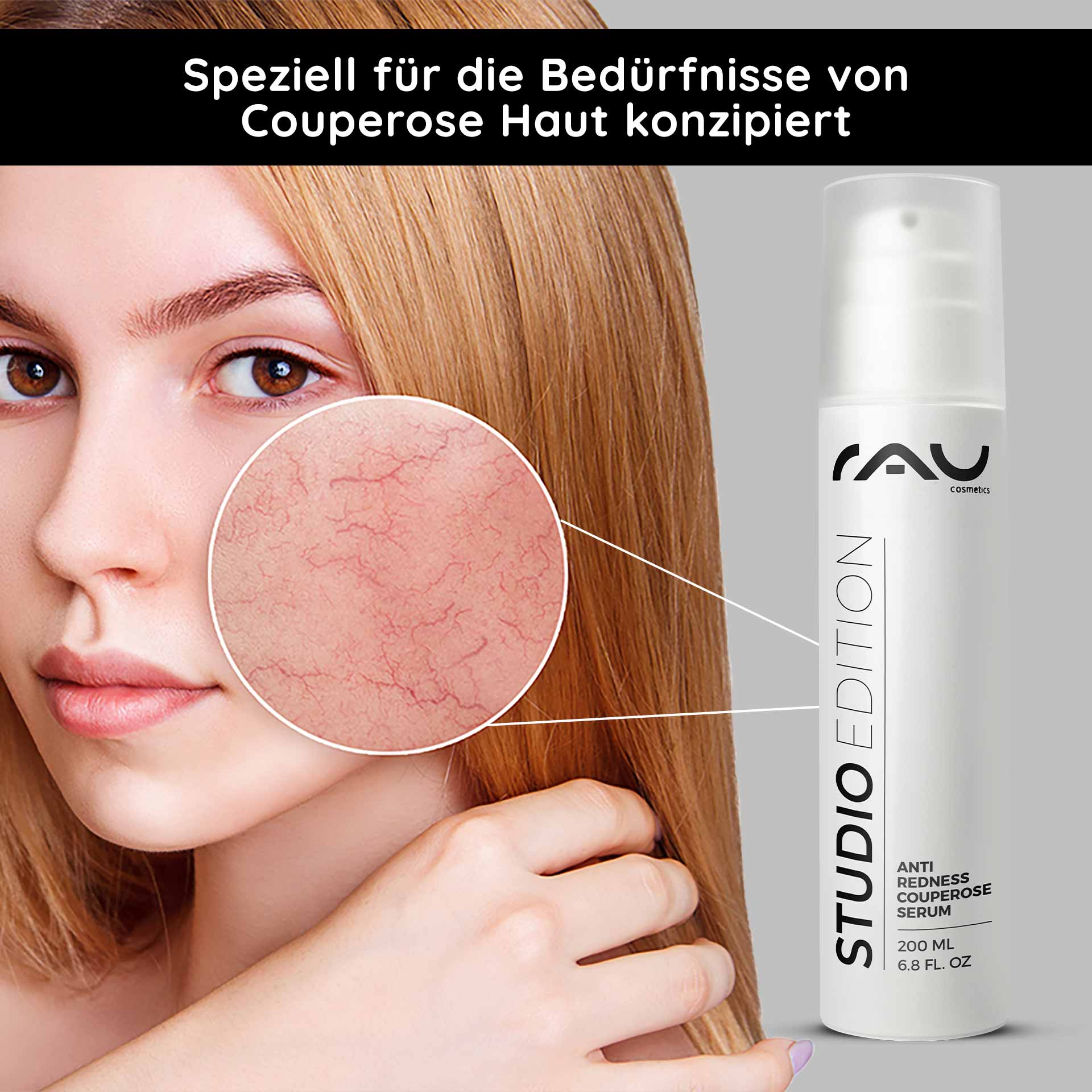 Anti Redness Couperose Serum 200 ml for Rosacea Anti-Redness Couperose Serum von RAU Cosmetics, entwickelt für empfindliche Haut, hebt Rötungen im Wangenbereich hervor, mit einer Produktflasche mit 200 ml Fassungsvermögen.