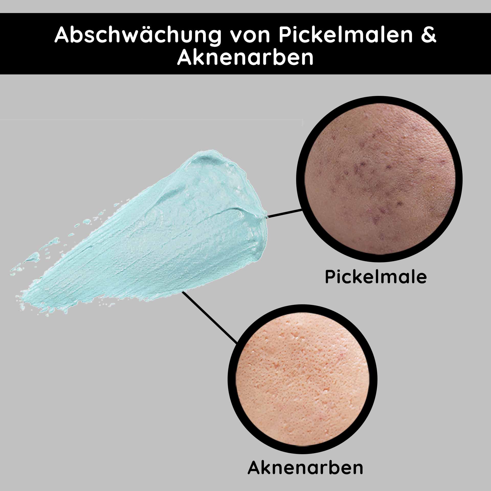 Fading of pimple marks and acne scars with blue cream, comparison of skin textures for skincare products.