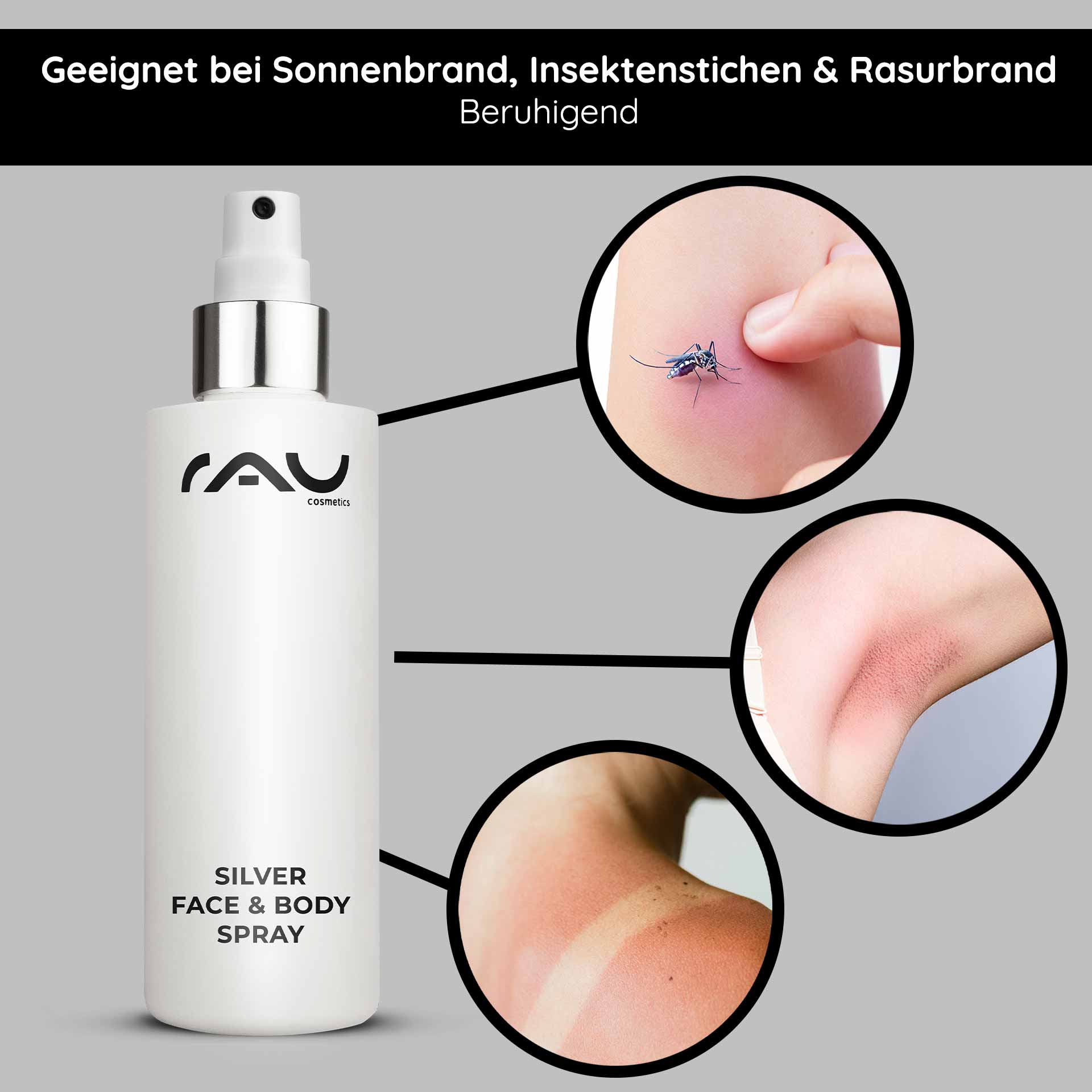 Silver Face & Body Spray 200 ml with Panthenol & Microsilver Silver Face & Body Spray von RAU Cosmetics, geeignet zur Linderung von Sonnenbrand, Insektenstichen und Rasurbrand, mit sichtbaren Beispielen für Hautirritationen und einem eleganten Sprühflaschendesign.