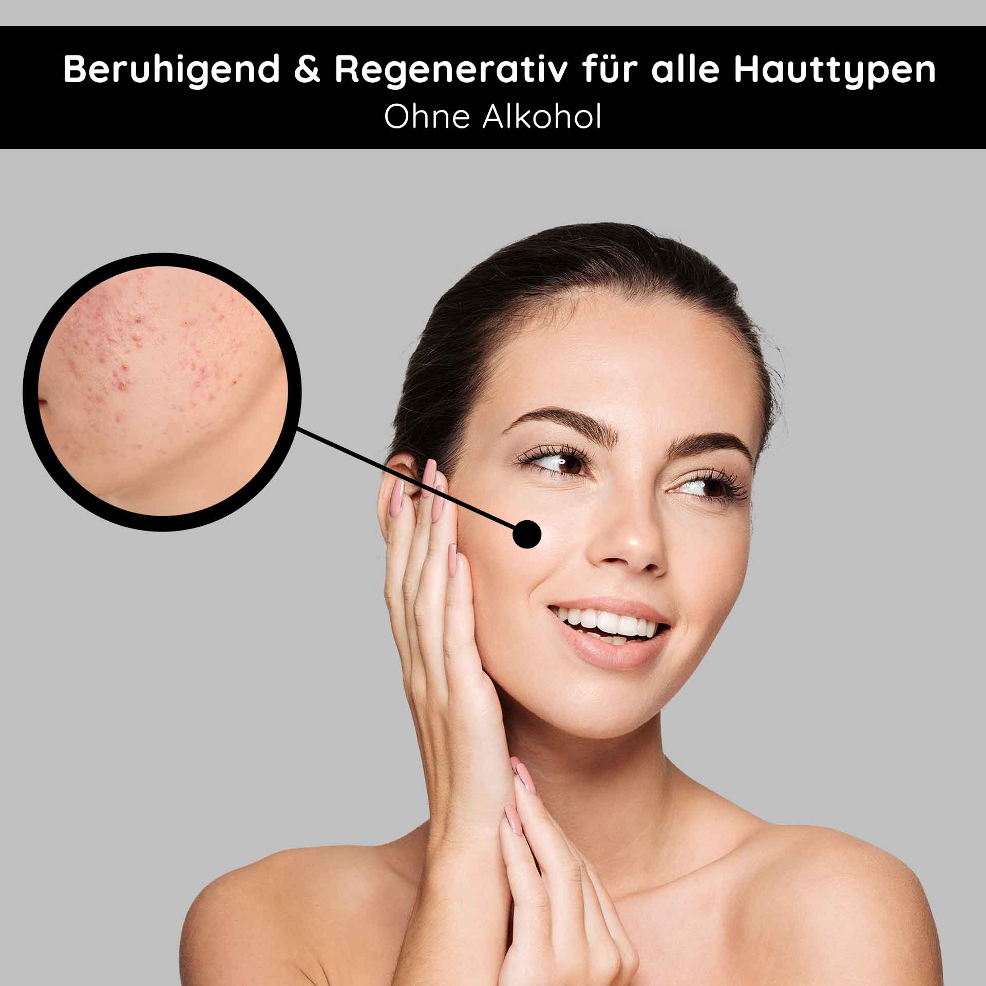 Tonic alcohol-free 200 ml with nettle extract Frau mit sanfter Haut, die ein beruhigendes, regeneratives Tonic ohne Alkohol anwendet, mit Zoom auf unreine Hautstellen.
