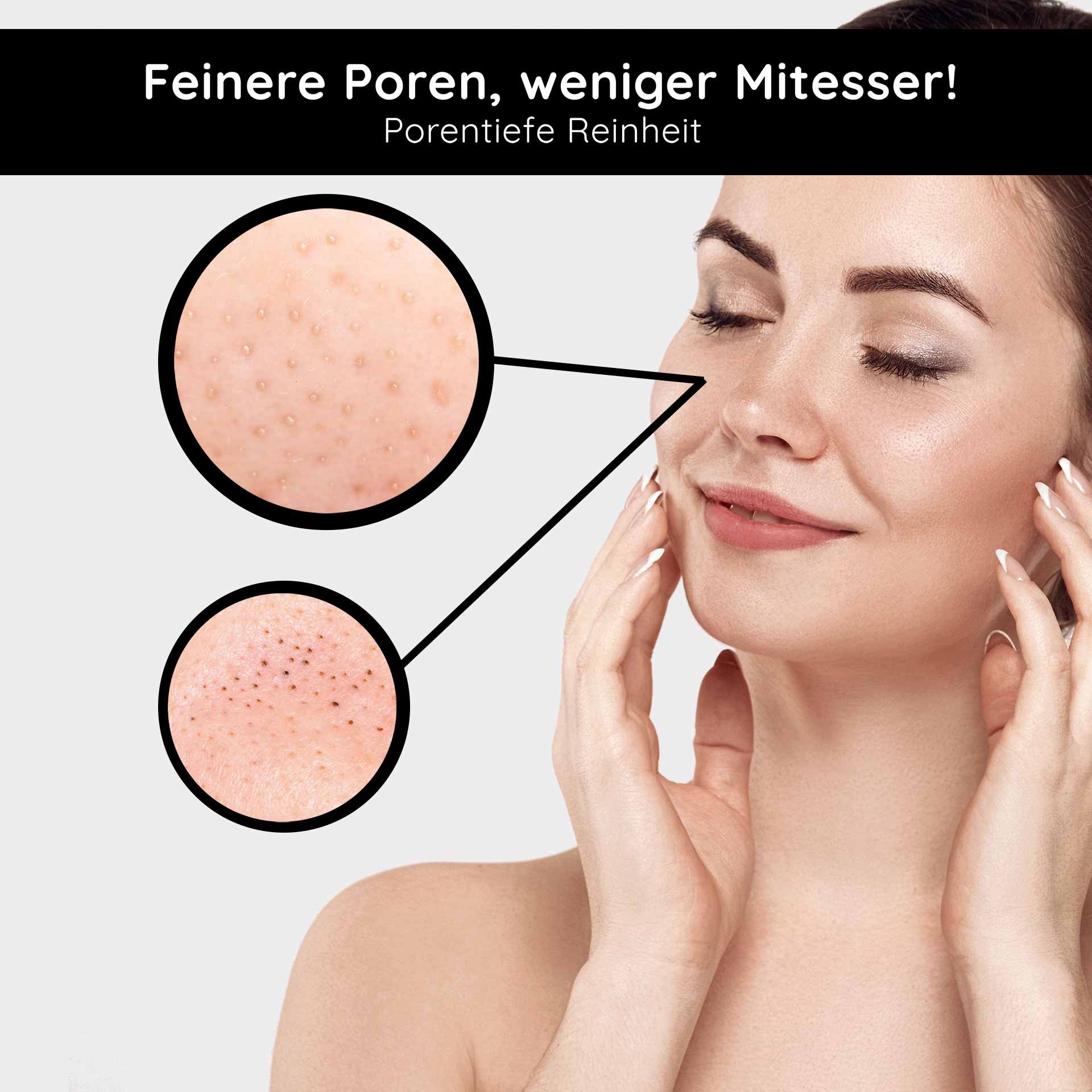 Frau mit sanfter Haut, die Gesichtspflege anwendet; vergrößerte Poren und Mitesser werden hervorgehoben, betont die Vorteile des RAU Cosmetics Deep Cleansing 2in1 Gesichtswassers.