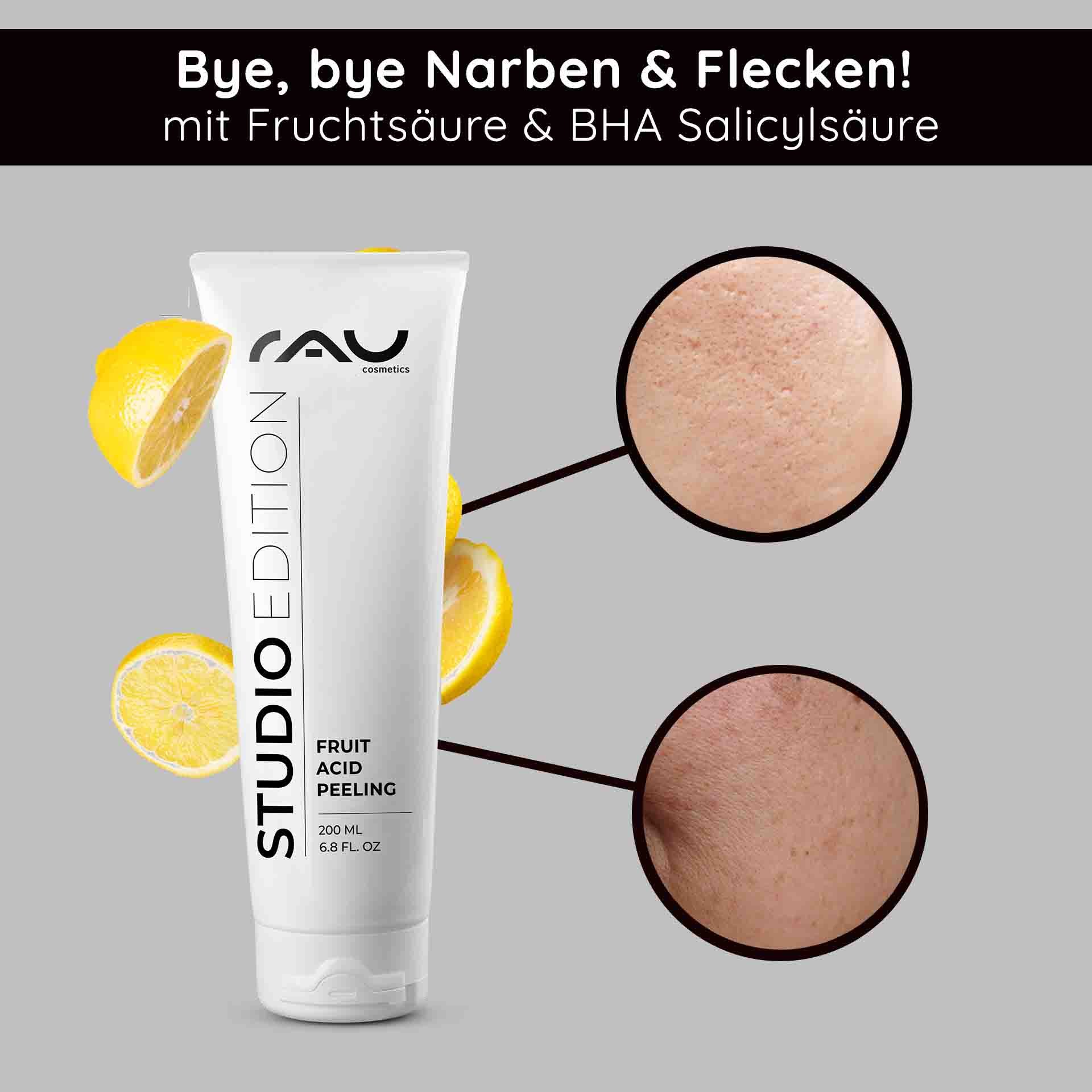 RAU Cosmetics Fruit Acid Peeling tube with lemon slices, highlighting the improvement of skin structure and the benefits of BHA salicylic acid to reduce scars and skin impurities.