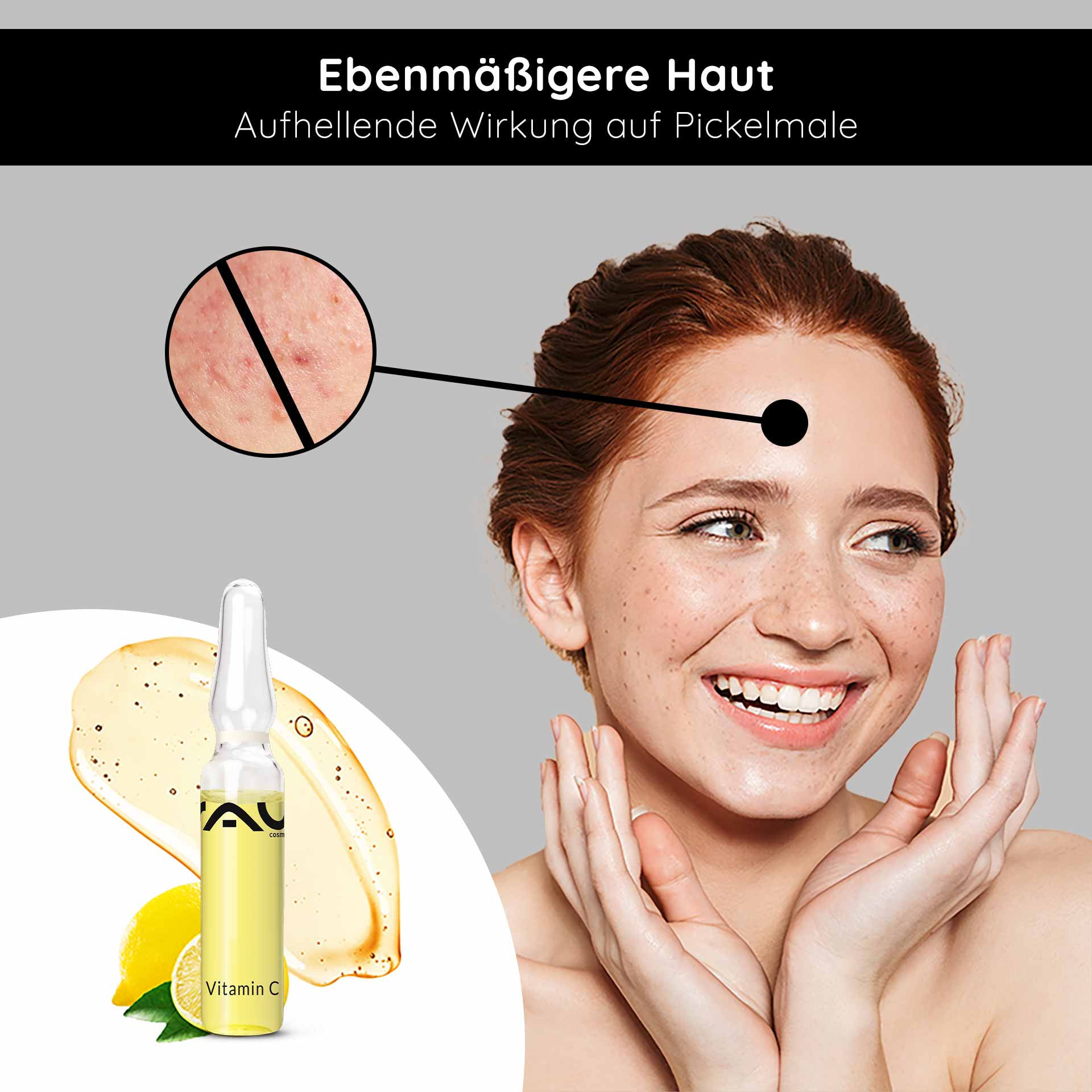 Vitamin C Ampoules 14x2 ml for mature & blemished skin Vitamin C Ampullen von RAU Cosmetics, lächelnde Frau mit strahlender Haut, Hautunreinheiten im Fokus, aufhellende Wirkung, frische Zitrone und Serum abgebildet.