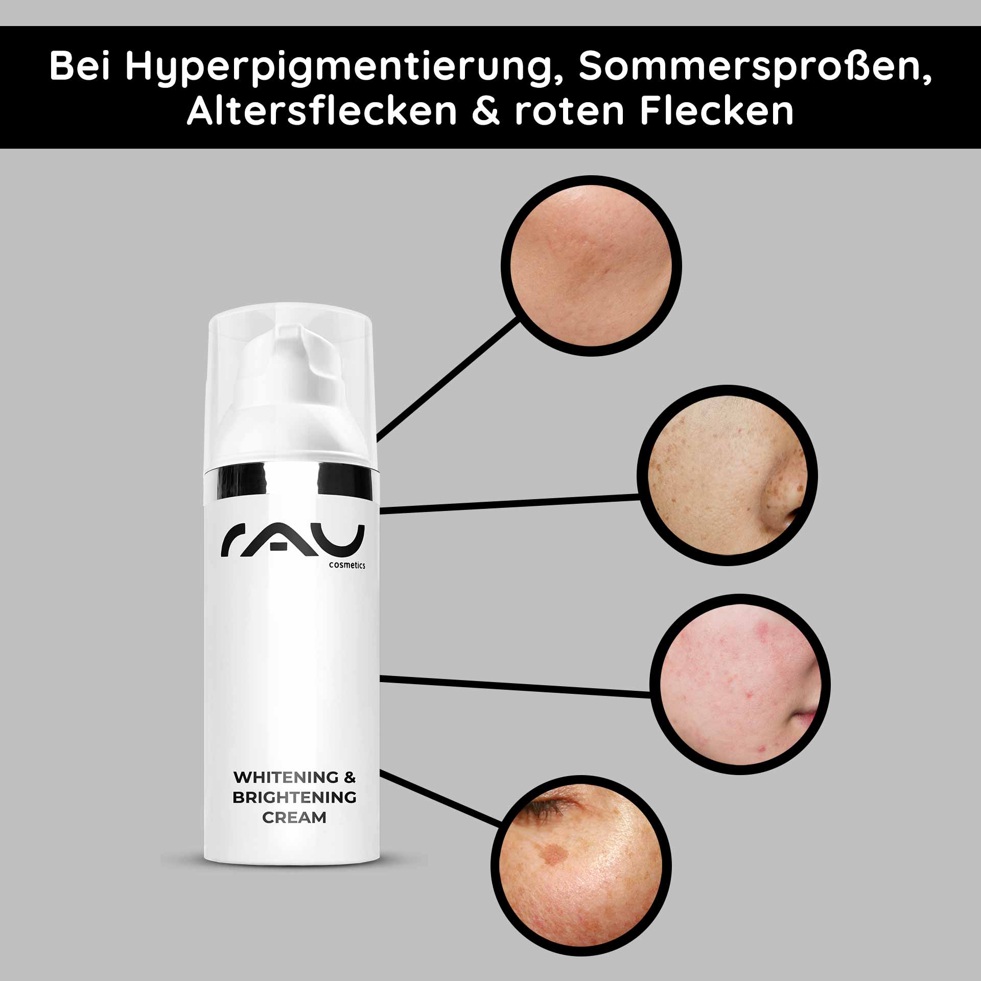 Whitening & Brightening Cream 50 ml Skin Brightener Die Whitening & Brightening Cream von RAU Cosmetics hebt Hautunreinheiten wie Hyperpigmentierung, Altersflecken und rote Flecken hervor und zeigt wirksame Lösungen zur Hautaufhellung.